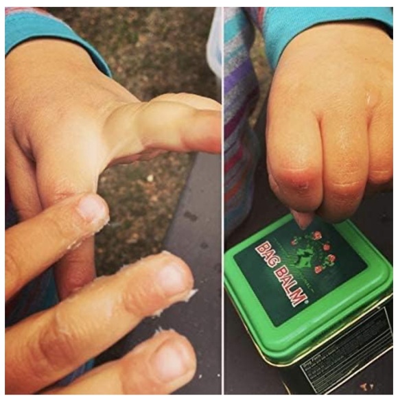 Skin Moisturizer — BAG BALM - Picture 10 of 16